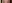 Ptosis Correction (levator surgery / eye-shape correction) — Wink Plastic Surgery Clinic