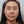 Ultraformer MPT (อัลตร้าฟอร์เมอร์ เอ็มพีที) — ก่อนทำ · เจฟิลคลินิก-สาขากังนัม