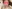 団子鼻修正（鼻尖縮小術） — コード美容外科クリニック