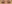 顔全体のヒアルロン酸注入（フルフェイスフィラー） — フルルン美容外科クリニック