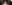 生え際の植毛（ヘアライン植毛） — 清潭OKクリニック