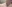 僧帽筋ボトックス（肩ボトックス） — マイン美容外科クリニック