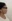 Platysma plication (corset platysmaplasty for double chin/jawline) — Dasipium Plastic Surgery Clinic