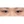 incisional double eyelid surgery — before (5days) · Hershey Plastic Surgery Clinic