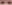 二重まぶた（自然癒着法） — プロミス美容外科クリニック