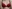 豊胸術（シリコンインプラント／人工乳腺） — エイト美容外科クリニック