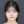two-jaw surgery (bimaxillary orthognathic surgery) — after (40days) · ReFace Dental Hospital