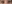 眼瞼下垂手術（目つき矯正） — エイペックス美容外科クリニック