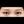 Aegyo-sal filler (under-eye 'love band' / pretarsal roll filler) — after · Pixel Lab Plastic Surgery Clinic