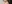 切開法（全切開法二重術） — ルホ美容外科クリニック