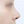 Nasal osteotomy (nasal bone narrowing) — after (7days) · Pop Plastic Surgery Clinic