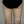 Full-body liposuction — after (21days) · Aurora Clinic