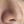 ไฮดร้าเฟเชียล (Aqua Peel ทำความสะอาดรูขุมขน) — ก่อนทำ · คลินิก Only P