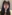 糸リフト（スレッドリフト） — ジャスト美容外科クリニック