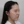 Density Lifting (RF skin tightening / lifting) — before · Ripain Clinic