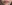 唇のヒアルロン酸注入（リップヒアルロン酸） — ロリポップ美容外科クリニック