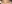 裏ハムラ法（経結膜的眼窩脂肪移動術） — オメガ美容外科クリニック