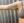 Brachioplasty (arm lift) — before (30days) · Cheongdam OK Plastic Surgery Clinic
