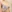 豊胸術（シリコンインプラント／人工乳腺） — エイト美容外科クリニック