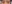 裏ハムラ法（経結膜的眼窩脂肪移動術） — ルホ美容外科クリニック