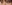 二重まぶた（自然癒着法） — ルホ美容外科クリニック