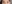 二重まぶた（自然癒着法） — プロミス美容外科クリニック