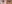 裏ハムラ法（経結膜的眼窩脂肪移動術） — プレジャー美容外科クリニック