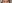 Lower Eyelid Fat Repositioning (transconjunctival) — Pleasure Plastic Surgery Clinic