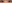 上眼瞼のたるみ取り（上眼瞼リフト・眉下切開） — ルホ美容外科クリニック