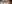 眼瞼下垂手術（目つき矯正） — エイペックス美容外科クリニック