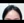 Forehead reduction (hairline lowering surgery) — before (7days) · Batang Plastic Surgery Clinic