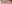 眼瞼下垂手術（目つき矯正） — IK美容外科クリニック