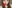 鼻尖形成術（自家軟骨移植） — ウィバース美容外科クリニック