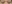 二重まぶた（自然癒着法） — イエロー美容外科クリニック
