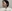 糸リフト（スレッドリフト） — ジャスト美容外科クリニック