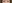 裏ハムラ法（経結膜的眼窩脂肪移動術） — ハッシュ美容外科クリニック