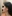 jaw angle reduction (mandibular angle osteotomy) — Uri Plastic Surgery Clinic