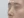 Nasal osteotomy (nasal bone narrowing) — after (7days) · The Ollim Plastic Surgery Clinic