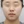 ฉีดสลายไขมันหน้า (เมโสแฟตแก้ม) — หลังทำ · เจย์ฟิล คลินิก - สาขาริมแม่น้ำ