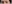 二重まぶた（自然癒着法） — ジャスト美容外科クリニック