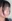 鼻の修正手術 — JT美容外科クリニック