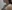 Double chin liposuction (submental liposuction) — Uri Plastic Surgery Clinic