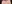 裏ハムラ法（経結膜的眼窩脂肪移動術） — プレジャー美容外科クリニック