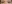 涙袋形成（脂肪注入） — ファクト美容外科クリニック