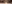 二重まぶた（自然癒着法） — プロミス美容外科クリニック