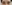 二重まぶた（自然癒着法） — プロミス美容外科クリニック