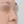 ผ่าตัดแก้ไขผนังกั้นช่องจมูกคด (Septoplasty) — ก่อนทำ (14วัน) · คลินิกศัลยกรรมพลาสติ์ พาดา