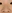 Septoplasty (deviated nasal septum correction) — Kobi-Ju Clinic