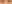 裏ハムラ法（経結膜的眼窩脂肪移動術） — アンド美容外科クリニック
