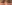 裏ハムラ法（経結膜的眼窩脂肪移動術） — プレジャー美容外科クリニック